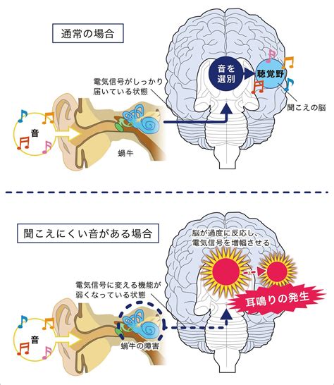 左耳耳鳴時辰